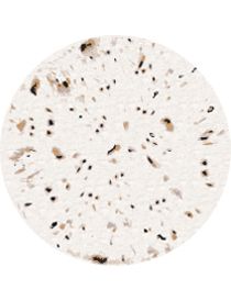 OSLO RUG